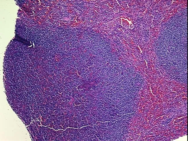 Tissue FFPE Sections, Lymphoid tissue - image 1