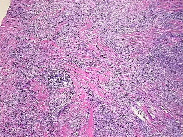 Tissue FFPE Sections, Lymphoid tissue - image 1