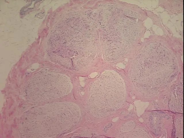 Tissue FFPE Sections, Peripheral nerve - image 1