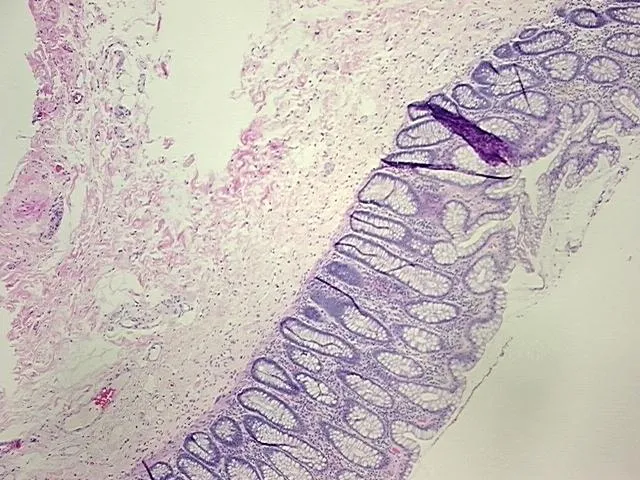 Tissue FFPE Sections, Rectum - image 1