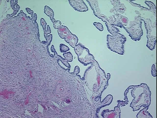Tissue FFPE Sections, Fallopian tube - image 1
