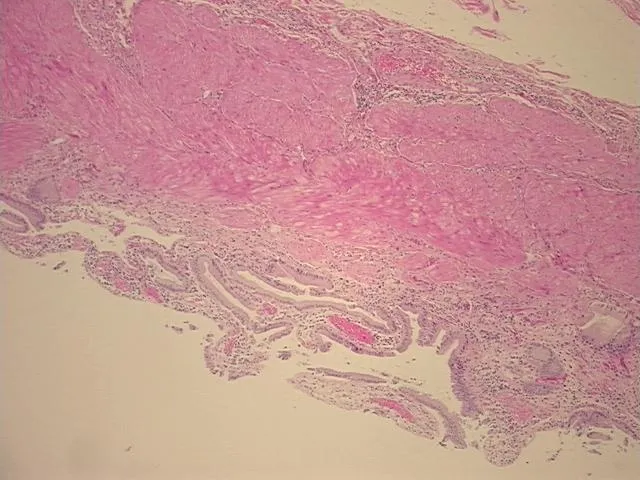 Tissue FFPE Sections, Gallbladder - image 1