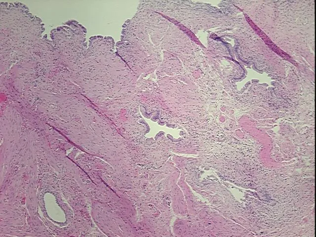 Tissue FFPE Sections, Gallbladder - image 1