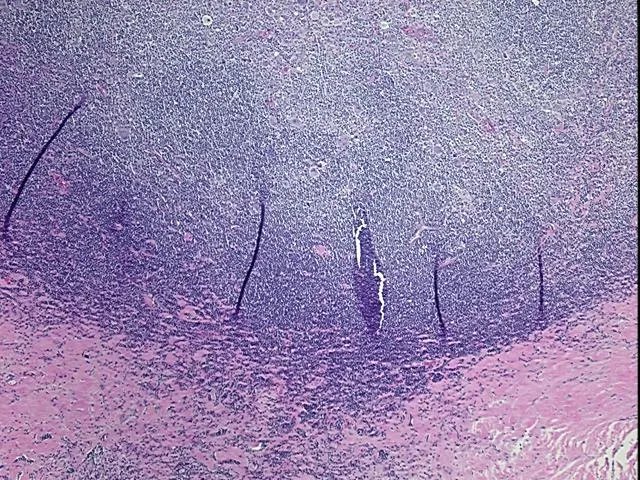 Tissue FFPE Sections, Lymphoid tissue - image 1