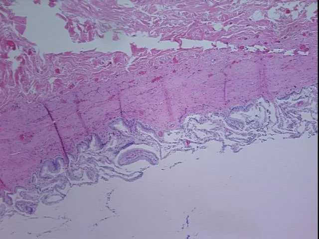 Tissue FFPE Sections, Gallbladder - image 1