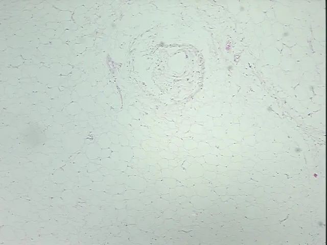 Tissue FFPE Sections, Adipose tissue - image 1