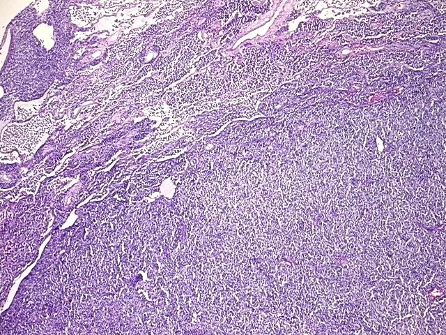 Tissue FFPE Sections, Lymphoid tissue - image 1
