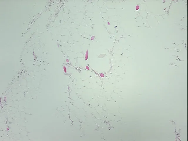 Tissue FFPE Sections, Adipose tissue - image 1