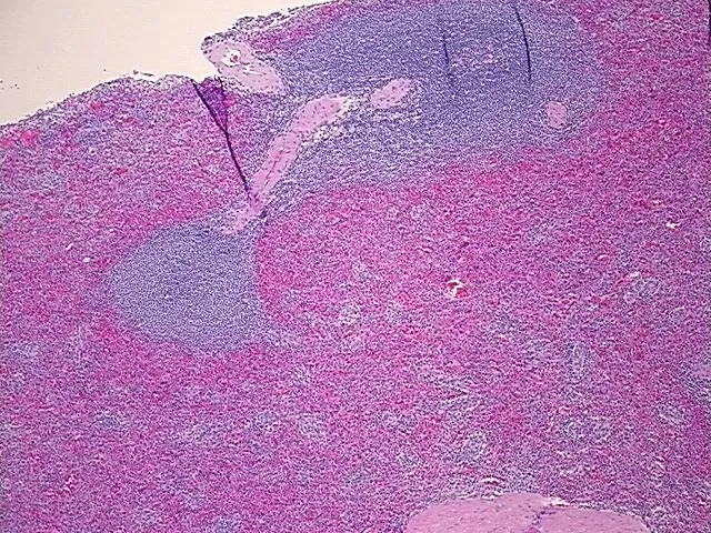 Tissue FFPE Sections, Spleen - image 1