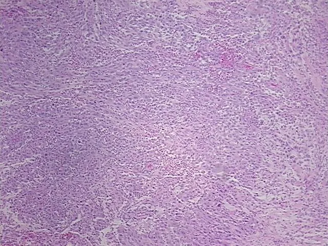 Tissue FFPE Sections, Small intestine - image 1