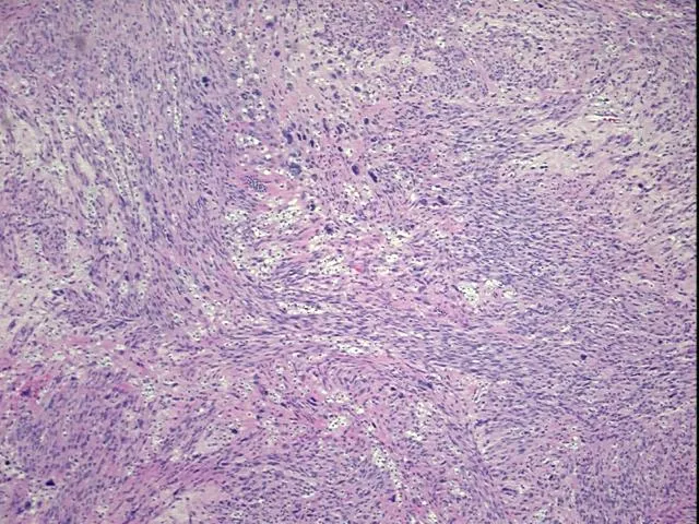 Tissue FFPE Sections, Soft tissue - image 1