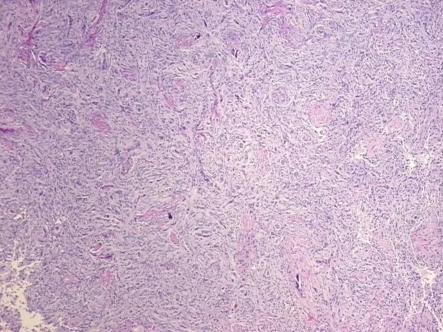 Tissue FFPE Sections, Brain - image 1