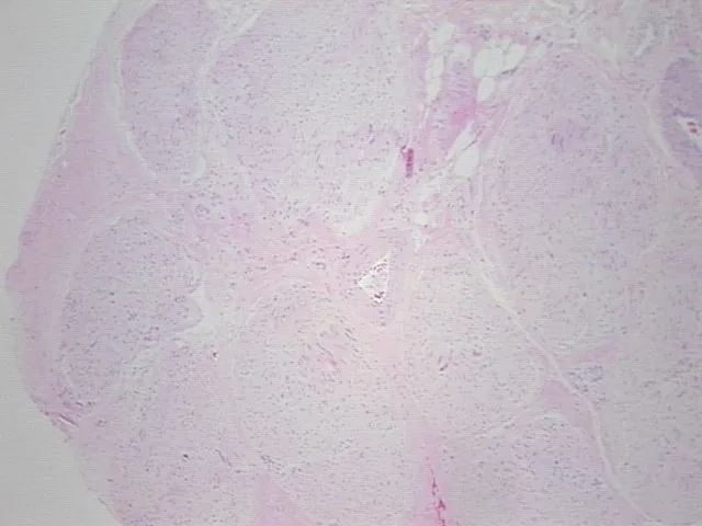 Tissue FFPE Sections, Peripheral nerve - image 1