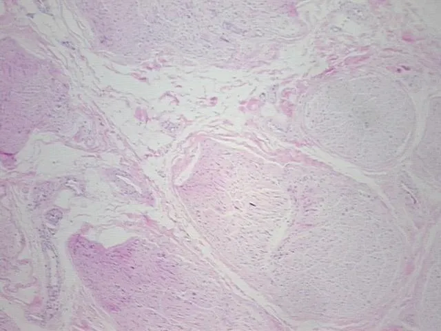 Tissue FFPE Sections, Peripheral nerve - image 1