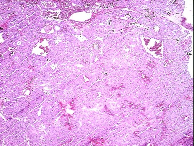 Tissue FFPE Sections, Thyroid gland - image 1