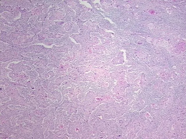 Tissue FFPE Sections, Gallbladder - image 1