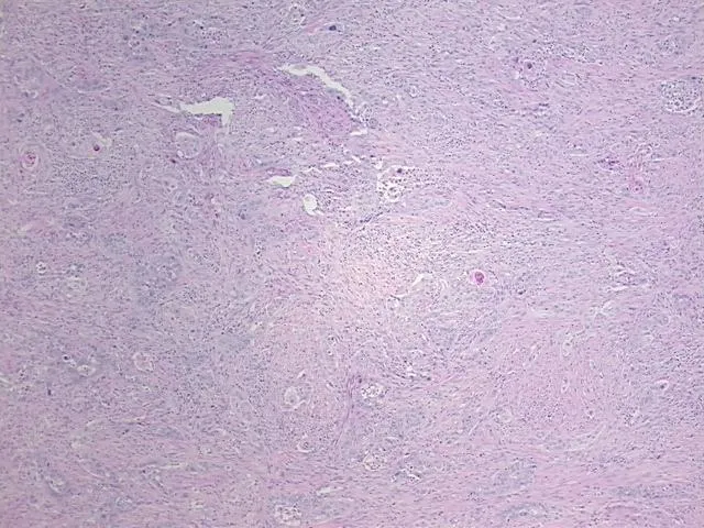 Tissue FFPE Sections, Gallbladder - image 1