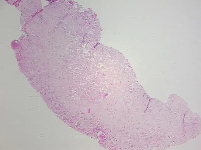 Tissue FFPE Sections, Brain - image 1