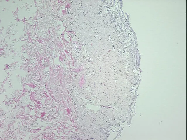 Tissue FFPE Sections, Gallbladder - image 1