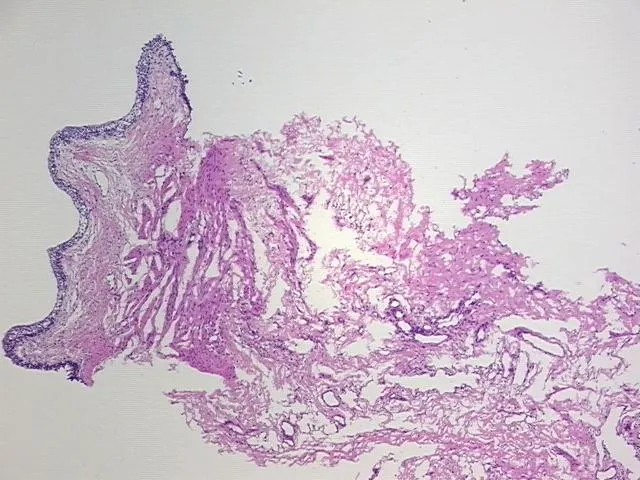 Tissue FFPE Sections, Ureter - image 1