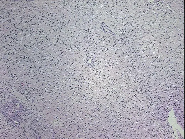 Tissue FFPE Sections, Soft tissue - image 1