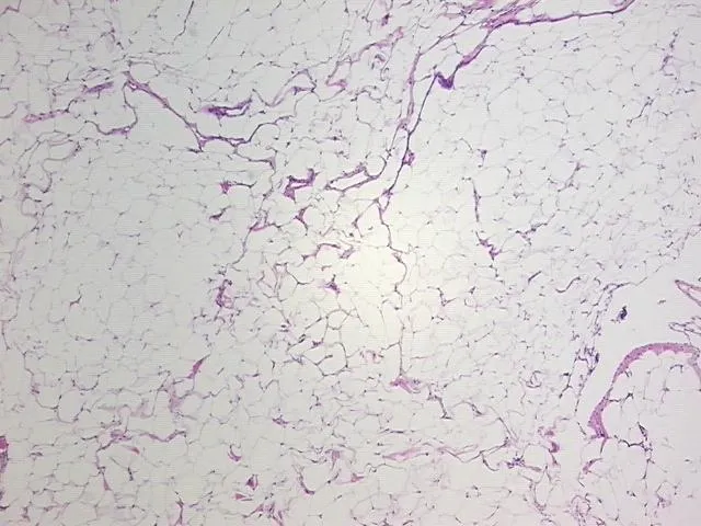 Tissue FFPE Sections, Adipose tissue - image 1