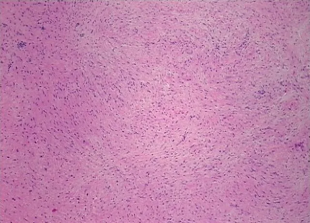 Tissue FFPE Sections, Peripheral nerve - image 1