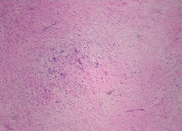 Tissue FFPE Sections, Peripheral nerve - image 1