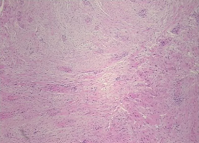 Tissue FFPE Sections, Peripheral nerve - image 1