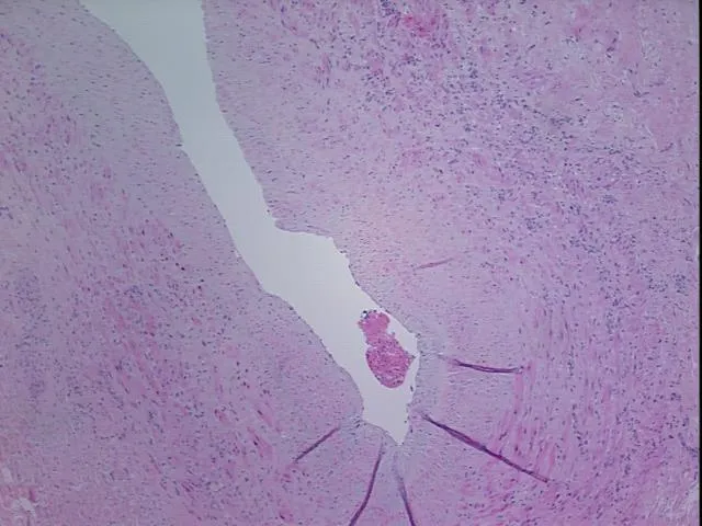 Tissue FFPE Sections, Vein: peripheral - image 1