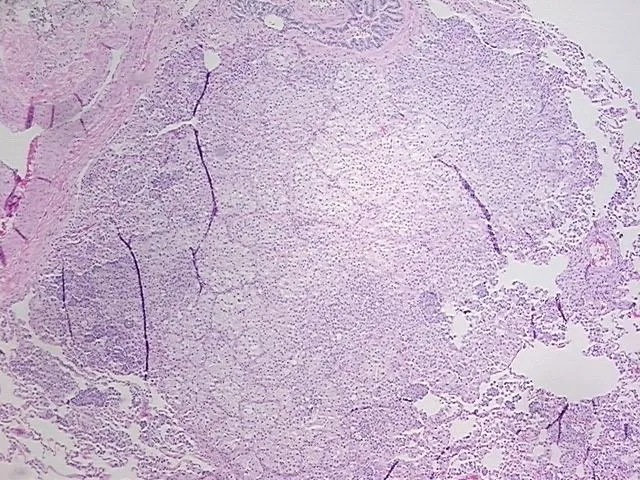 Tissue FFPE Sections, Unknown tissue - image 1