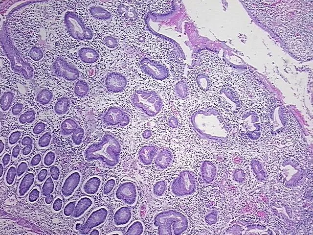 Tissue FFPE Sections, Jejunum - image 1