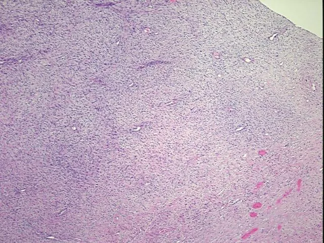 Tissue FFPE Sections, Soft tissue - image 1