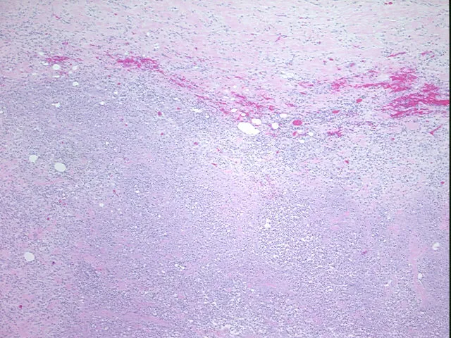 Tissue FFPE Sections, Aorta - image 1