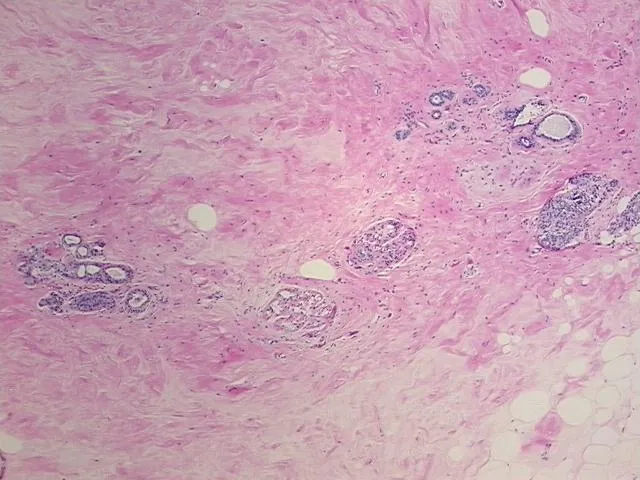 Tissue FFPE Sections, Breast - image 1