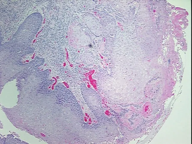 Tissue FFPE Sections, Larynx - image 1