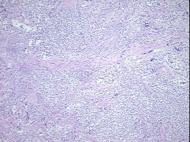 Tissue FFPE Sections, Testis - image 1