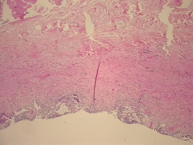 Tissue FFPE Sections, Gallbladder - image 1