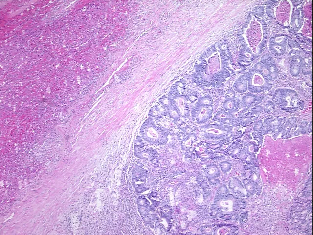 Tissue FFPE Sections, Colon - image 1