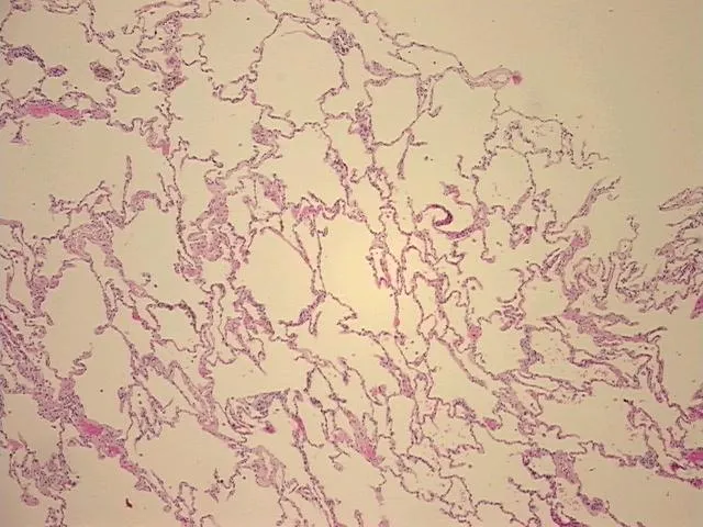 Tissue FFPE Sections, Lung - image 1