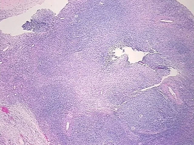 Tissue FFPE Sections, Ovary: right - image 1