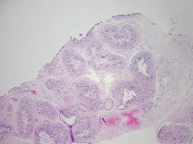 Tissue FFPE Sections, Epididymis - image 1