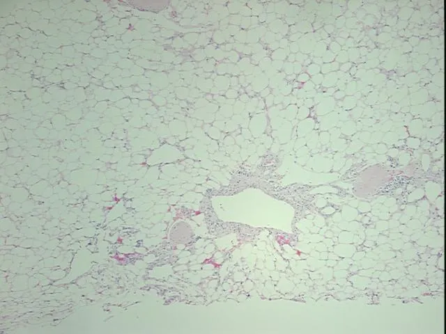 Tissue FFPE Sections, Soft tissue - image 1
