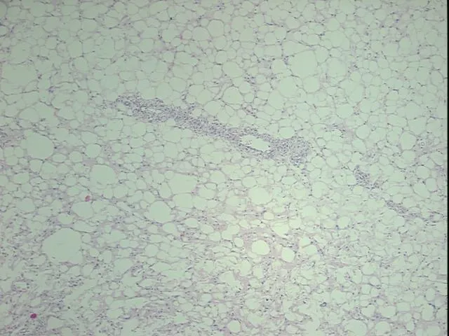 Tissue FFPE Sections, Soft tissue - image 1