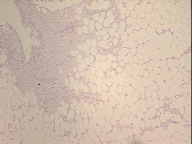 Tissue FFPE Sections, Appendix - image 1