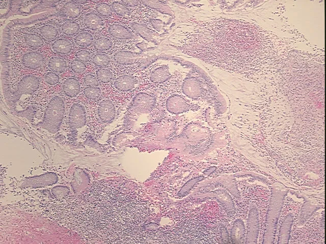 Tissue FFPE Sections, Appendix - image 1
