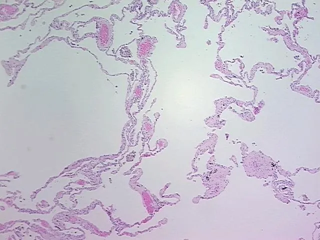 Tissue FFPE Sections, Lung - image 1