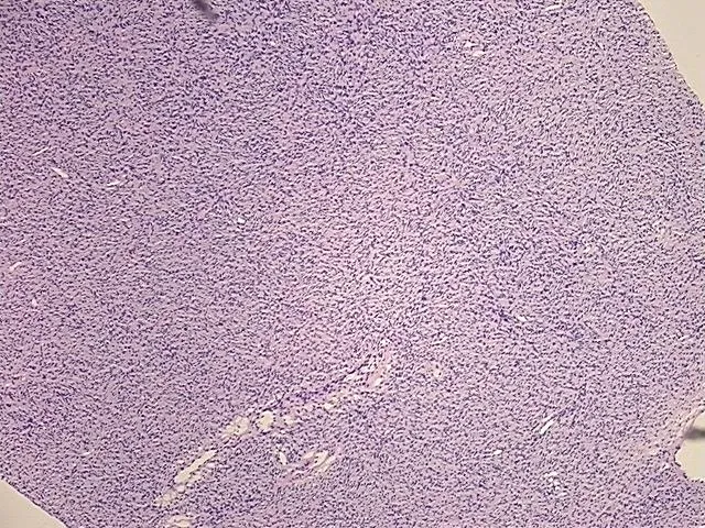 Tissue FFPE Sections, Soft tissue - image 1