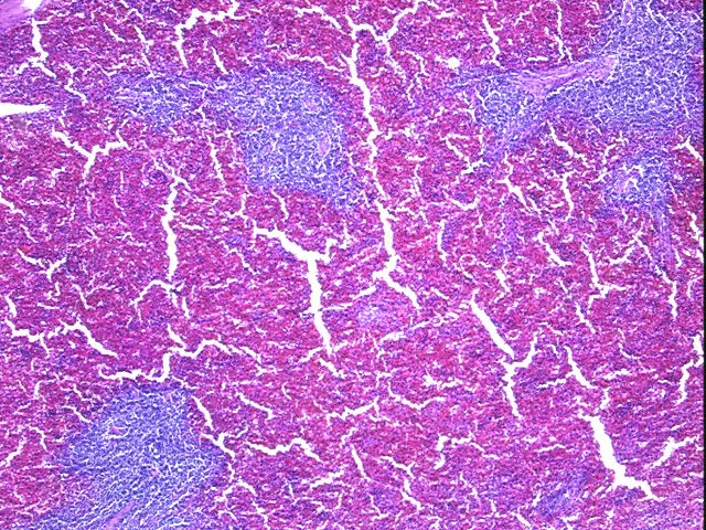 Tissue FFPE Sections, Lymphoid tissue - image 1