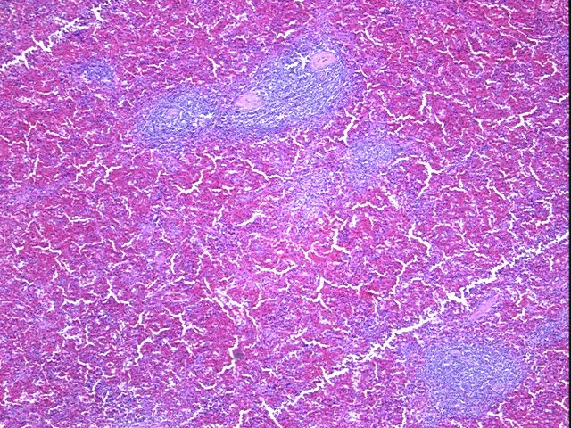 Tissue FFPE Sections, Lymphoid tissue - image 1